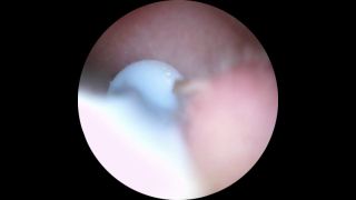 [MuchasVidas] Longhairluna Manyvids.23.12.09.Longhairluna.Ear.Wax.Limpieza