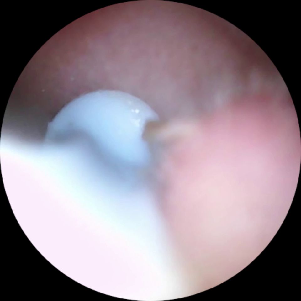 [MuchasVidas] Longhairluna Manyvids.23.12.09.Longhairluna.Ear.Wax.Limpieza