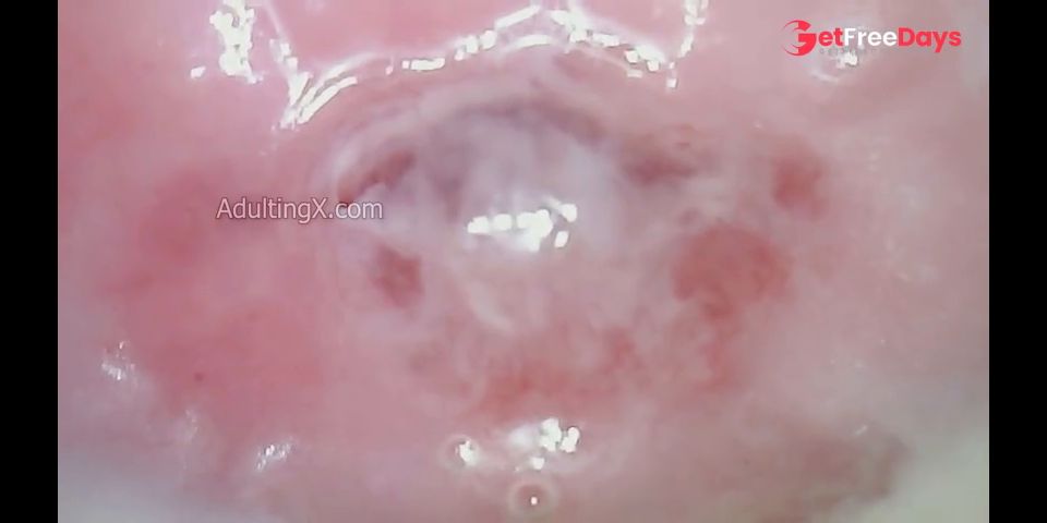 Creamy Cervix