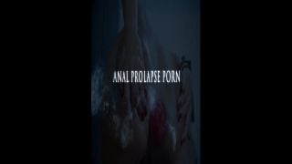 online adult clip 9 hairy anal fisting / fisting / mature porn