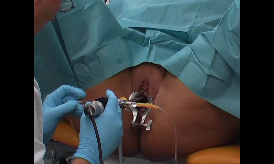 Spekula Examina la cistoscopia de la vejiga.