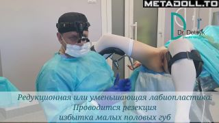 Gynecological Porn Videos - TheFantazy.com