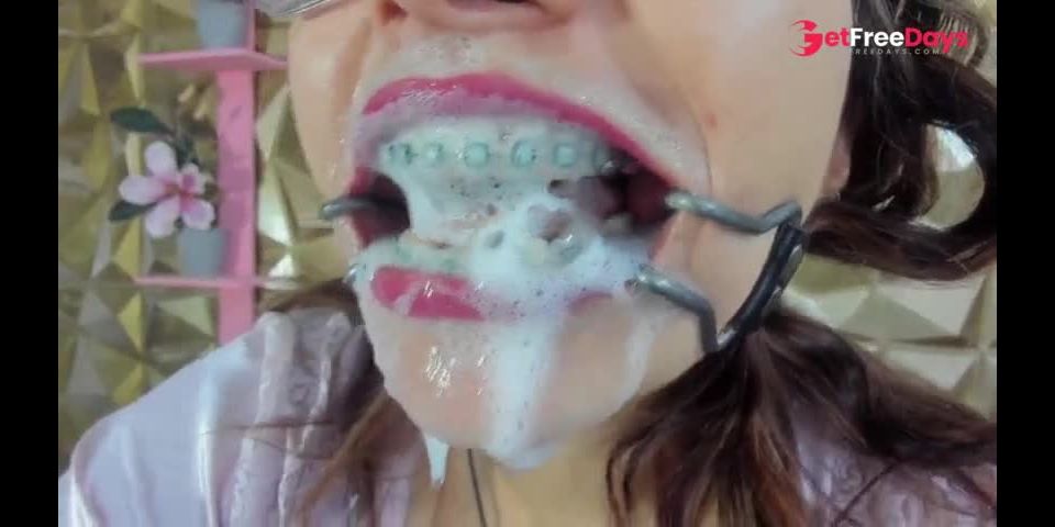 [GetFreeDays.com] mouth tongue braces teeth by auro smith chaturbate.com Porn Film May 2023