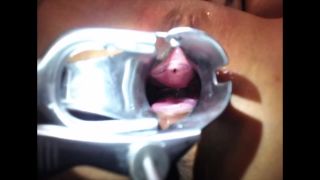 Insider's Look: Littlesubgirl Speculum Exam - Eye-Catching V