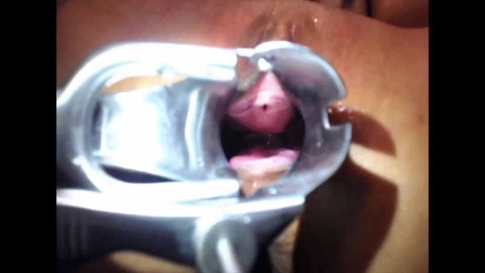 Insider's Look: Littlesubgirl Speculum Exam - Eye-Catching V