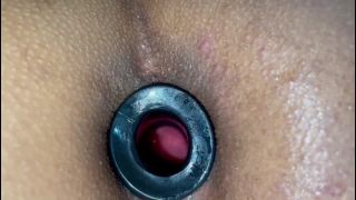 free video 42 fisuras anales y hemorroides big ass porn | Dilator Ass JOI | fetish