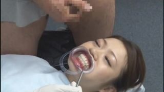 RCT-300 Cum In The Dentist!!!