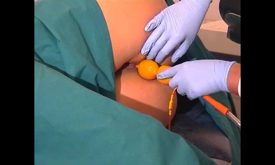 free xxx video 46 Medical Procedures - medical-fet.6316, furry femdom on femdom porn 