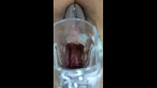 M@nyV1ds - XAMY_97 - nice view of a speculum in my big ass