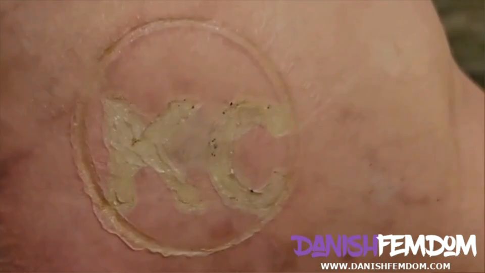 burnmarked and whippped.